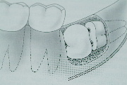 Oralchirurgie Berlin Potsdam Home Bild 3